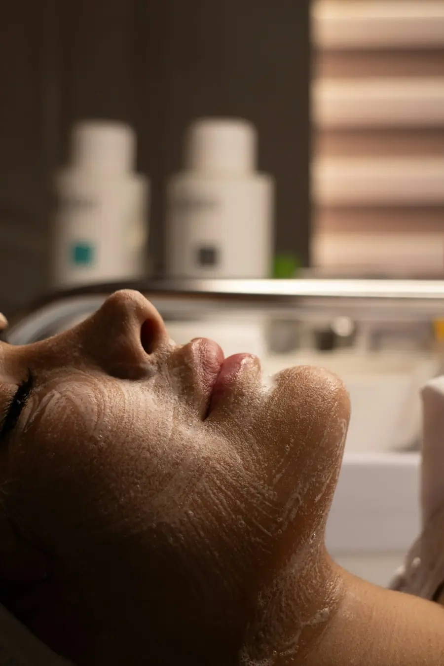 Microneedling treatment